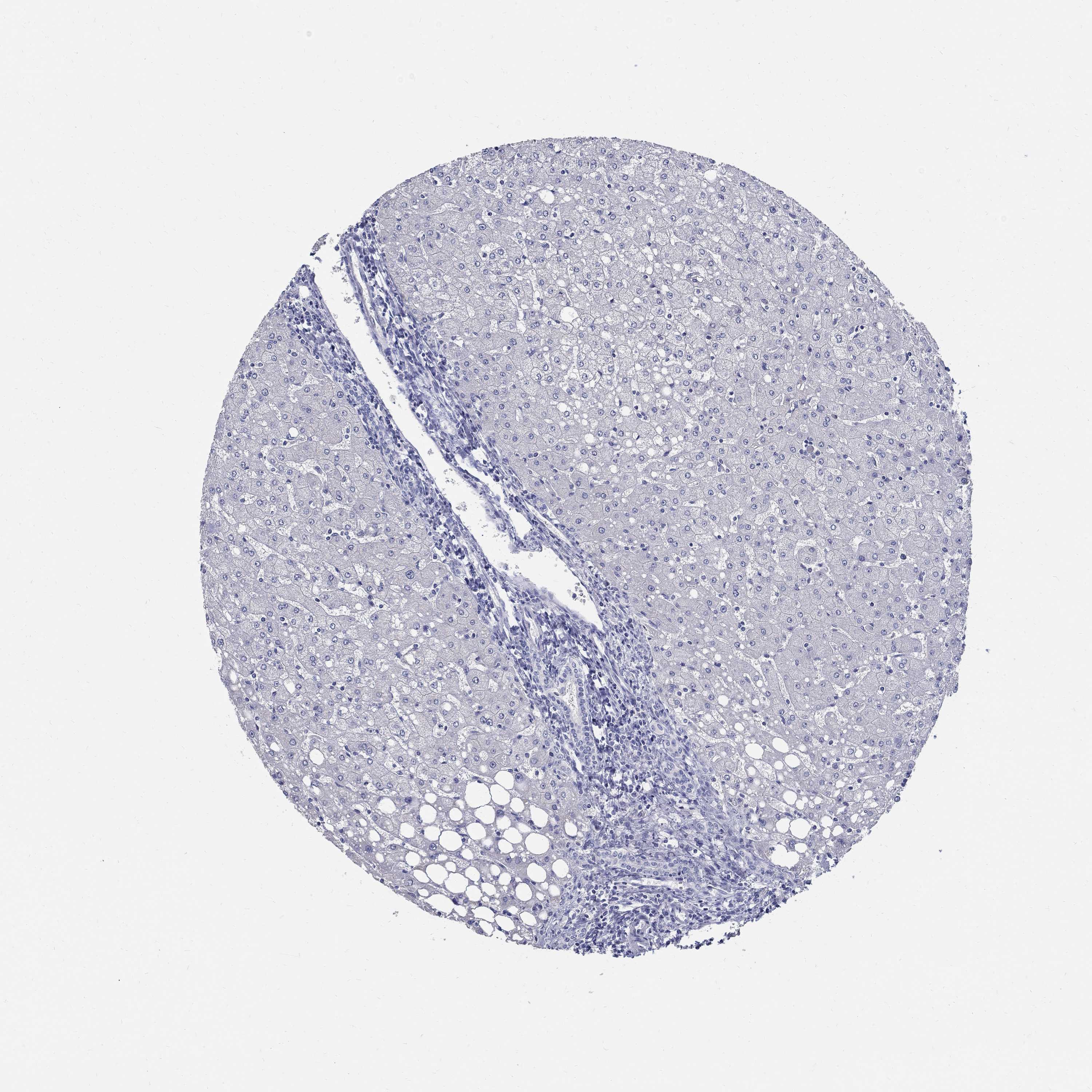 Tissue expression of SOX2 Staining in liver The Human Protein Atlas