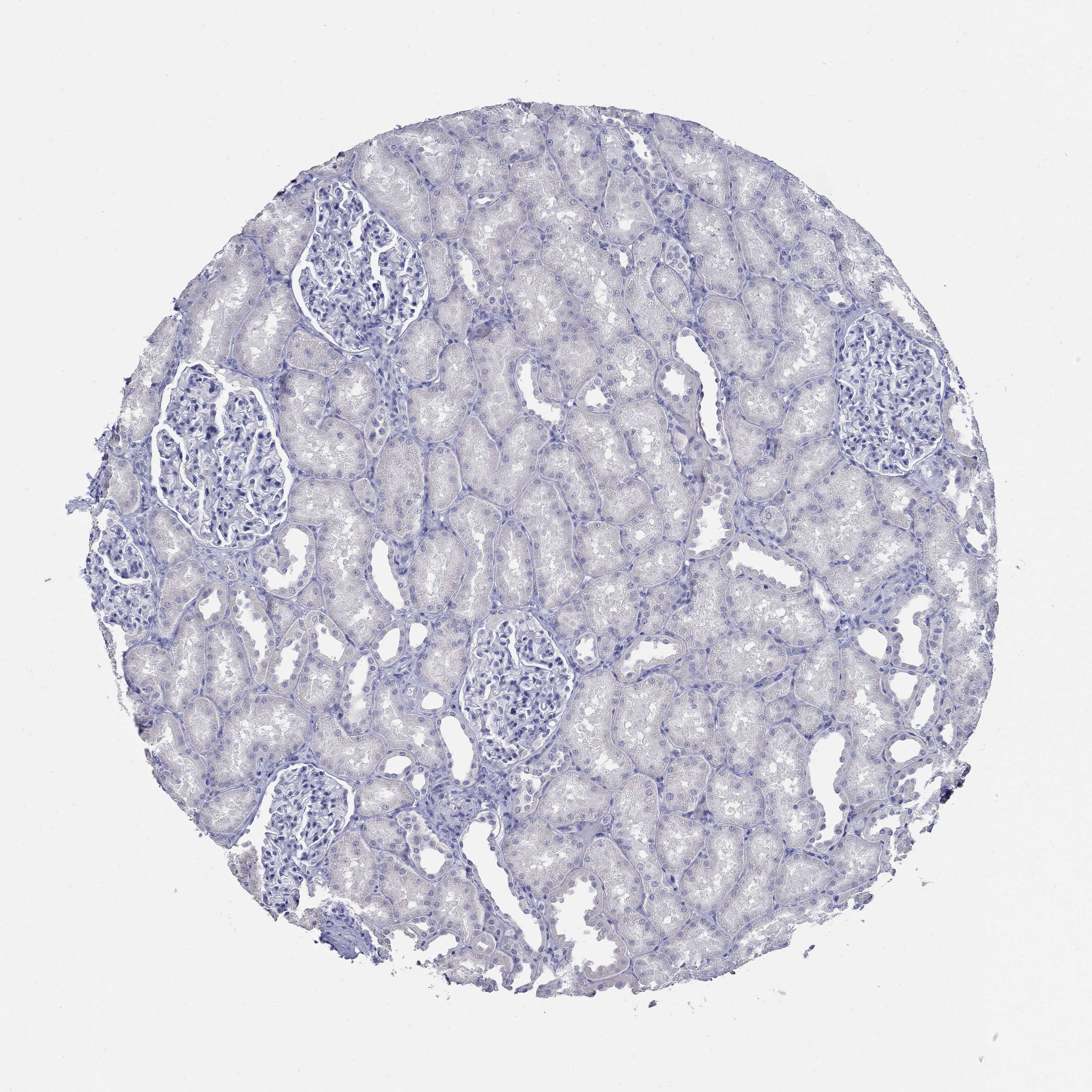 Tissue expression of SOX2 Staining in kidney The Human Protein Atlas