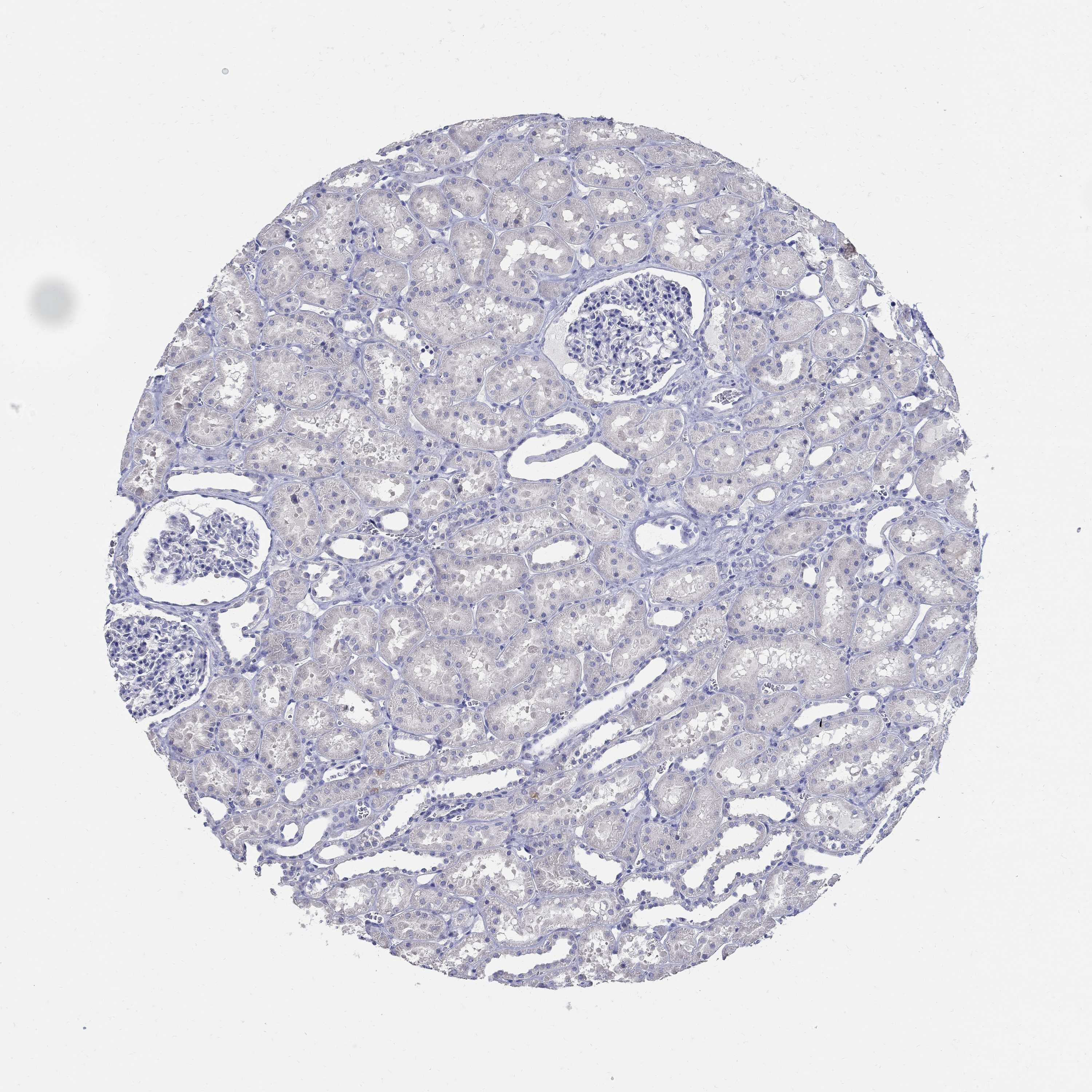 Tissue expression of SOX2 Staining in kidney The Human Protein Atlas