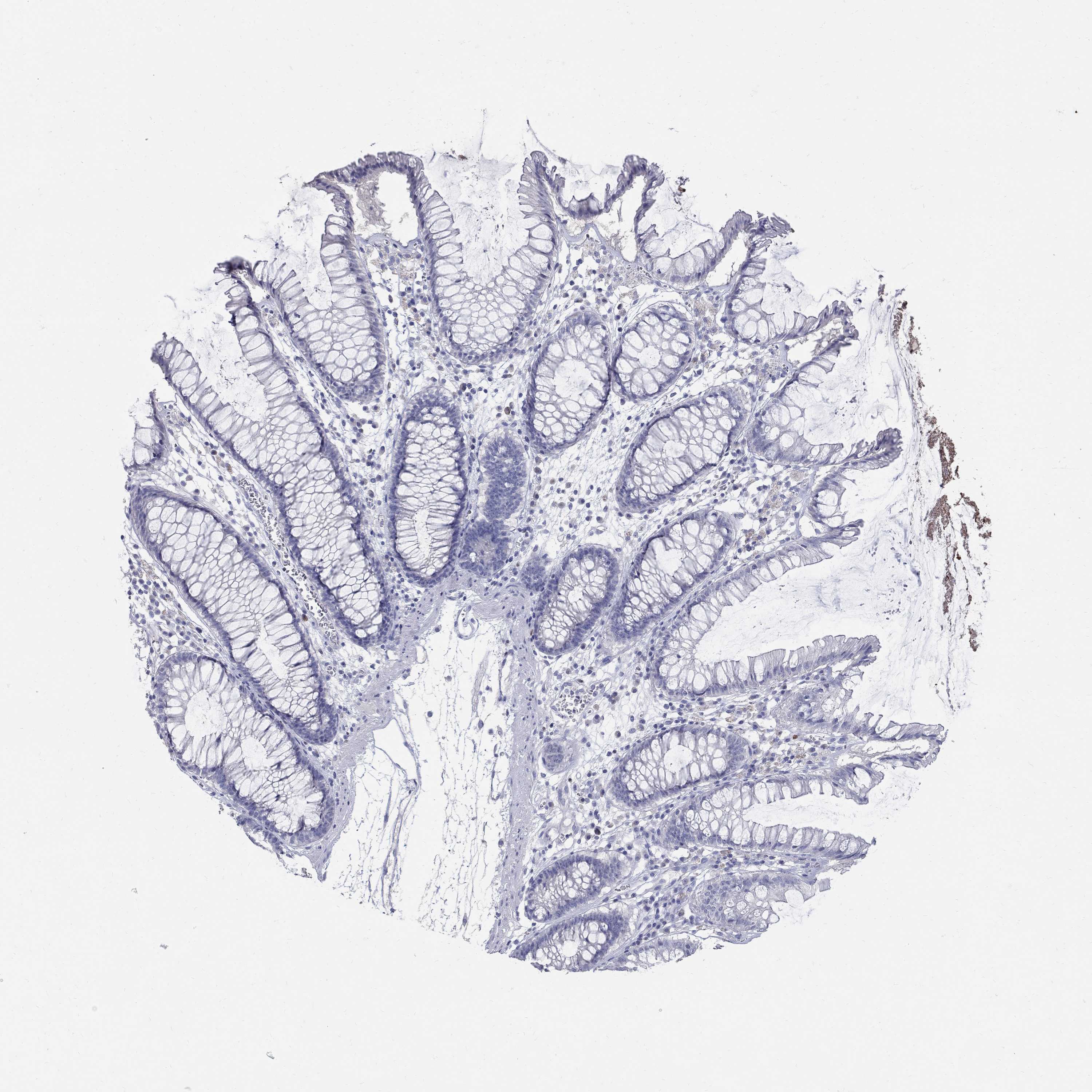 Tissue expression of SOX2 Staining in colon The Human Protein Atlas