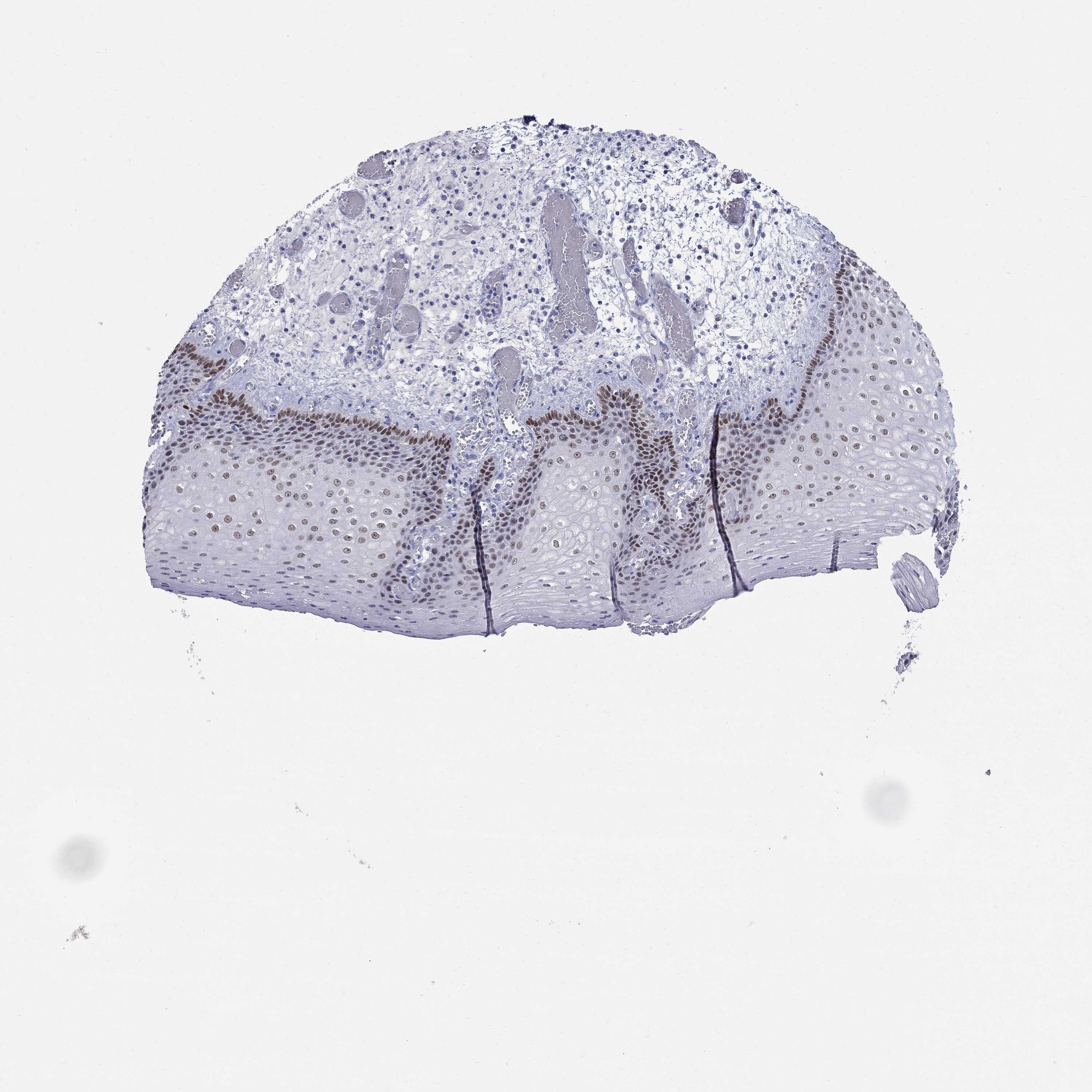 Tissue expression of SOX2 Staining in esophagus The Human Protein Atlas
