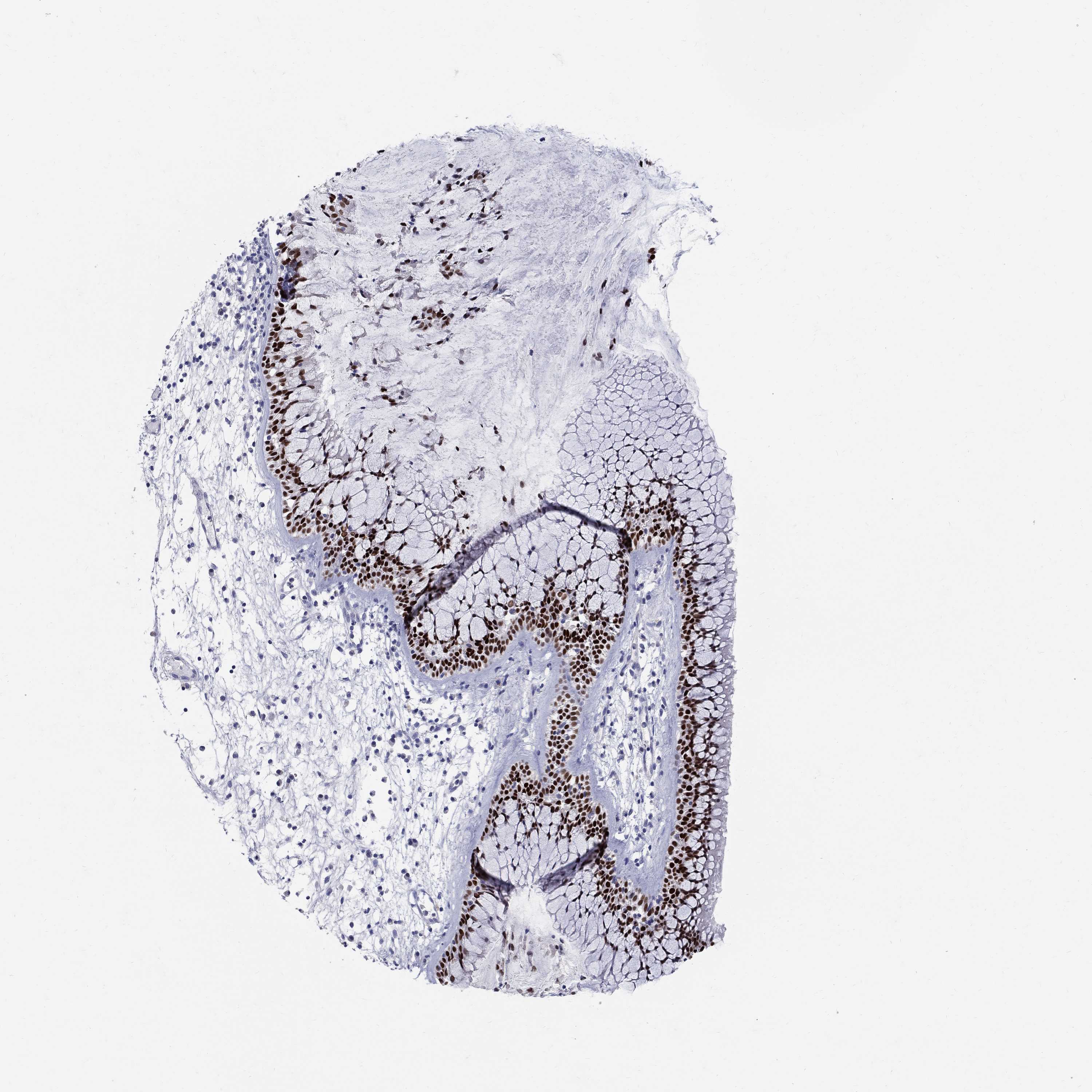 Tissue expression of SOX2 Staining in nasopharynx The Human Protein