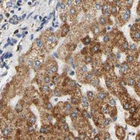 HPA IHC Liver — SFXN3