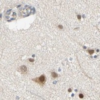 HPA IHC Cerebral cortex — SFXN3