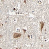 HPA IHC Cerebral cortex — CDK12