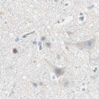 HPA IHC Cerebral cortex — EVA1A