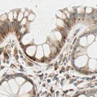 HPA IHC Colon — SPRY4