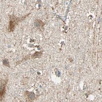 HPA IHC Cerebral cortex — SPRY4