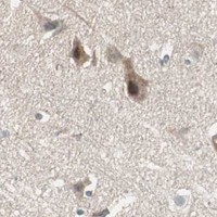 HPA IHC Cerebral cortex — MAD2L2