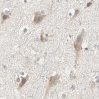HPA IHC Cerebral cortex — SFRP1