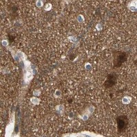 HPA IHC Cerebral cortex — PPP3CB