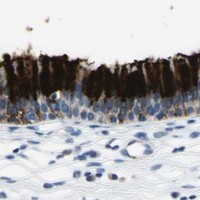 HPA IHC Nasopharynx — MUC5B
