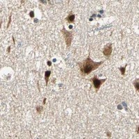 HPA IHC Cerebral cortex — PDK2
