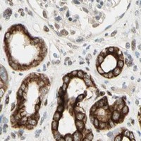 HPA IHC Kidney — ATXN1