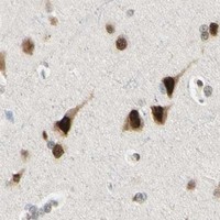 HPA IHC Cerebral cortex — ATXN1