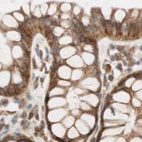 HPA IHC Colon — ABI1