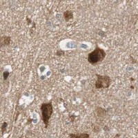 HPA IHC Cerebral cortex — ABI1