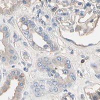 HPA IHC Kidney — PDPN