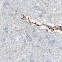 HPA IHC Cerebral cortex — PDPN