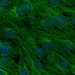 HPA008410: hTERT-RPE1 (serum starved)