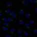 HPA008421: hTERT-RPE1 (serum starved)