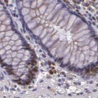 HPA IHC Colon — MCM5