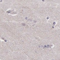 HPA IHC Cerebral cortex — MCM5