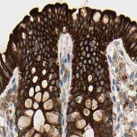 HPA IHC Colon — SKIL