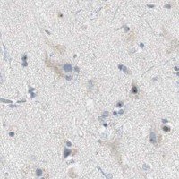 HPA IHC Cerebral cortex — MAP4K4