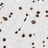HPA IHC Cerebral cortex — GLI2