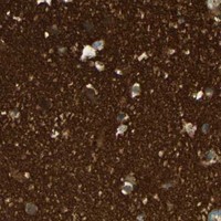 HPA IHC Cerebral cortex — AMPH