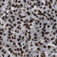 HPA IHC Pancreas — MDM2