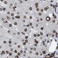 HPA IHC Liver — MDM2