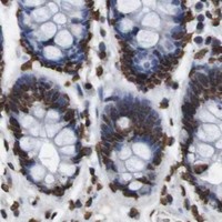HPA IHC Colon — MDM2