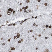 HPA IHC Cerebral cortex — MDM2