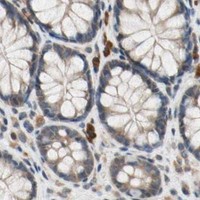 HPA IHC Colon — PRDX4