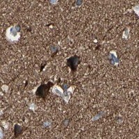 HPA IHC Cerebral cortex — TUBA1A