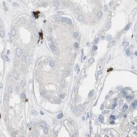 HPA IHC Kidney — CD247