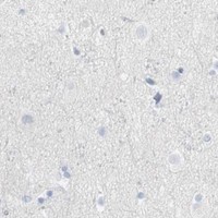 HPA IHC Cerebral cortex — CD247