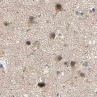 HPA IHC Cerebral cortex — RAD18