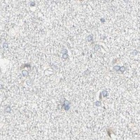 HPA IHC Cerebral cortex — CCNB2