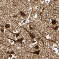 HPA IHC Cerebral cortex — MAPK9