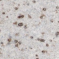 HPA IHC Cerebral cortex — RRBP1