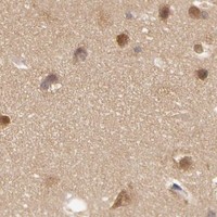 HPA IHC Hippocampus — AHSA1
