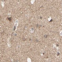 HPA IHC Cerebral cortex — SMAD9