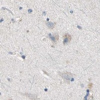 HPA IHC Cerebral cortex — NDFIP2