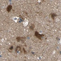 HPA IHC Cerebral cortex — NOL3