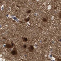 HPA IHC Cerebral cortex — NTRK3