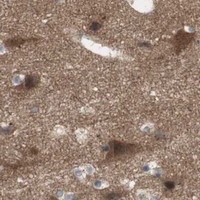 HPA IHC Cerebral cortex — OAZ1
