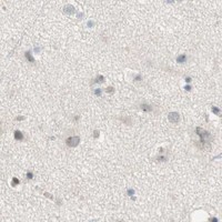 HPA IHC Cerebral cortex — JPH1